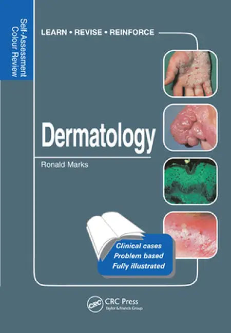 Dermatology: Self-Assessment Colour Review by Ronald Marks