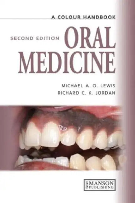 A Colour Handbook Oral Medicine, 2e by Lewis
