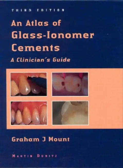 An Atlas of Glass-Ionomer Cements: Alinicians Guide by Mount