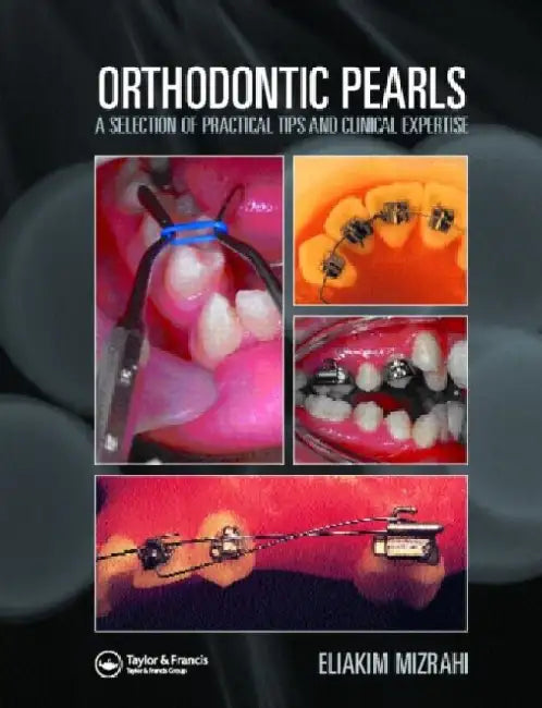 Orthodontic Pearls A Selection Of Practical Tips And Clinical Expertise by Mizrahi E.