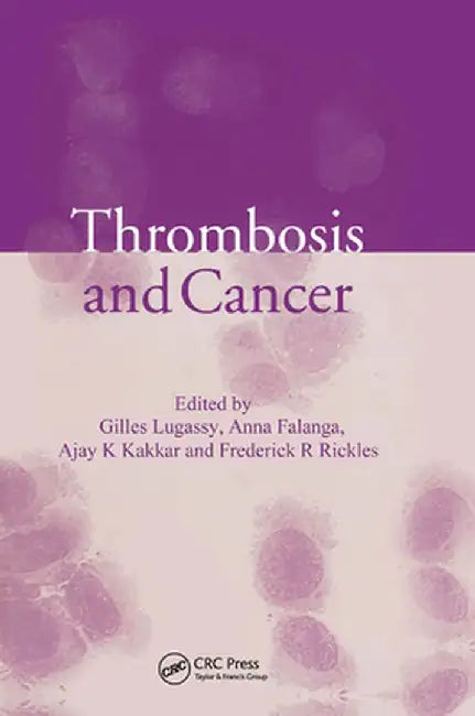Thrombosis And Cancer by Anna Falanga, Others