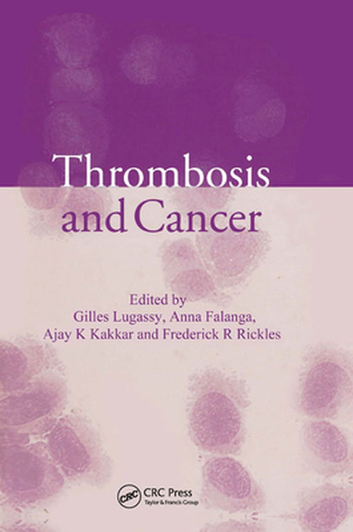 Thrombosis And Cancer by Anna Falanga, Others