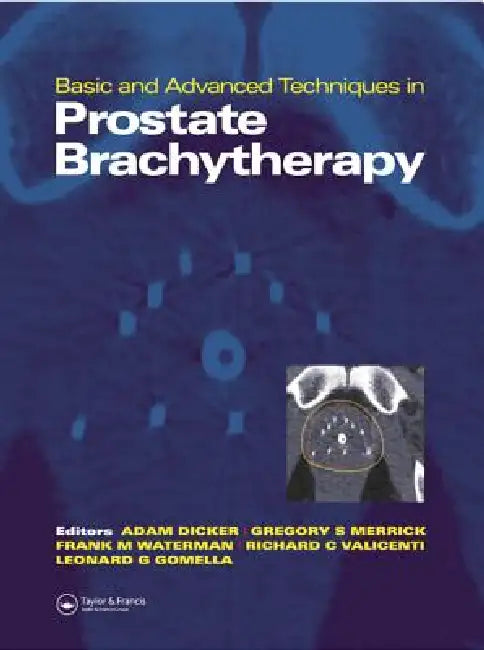 Basic and Advanced Techniques in Prostate Brachytherapy by Adam P. Dicker