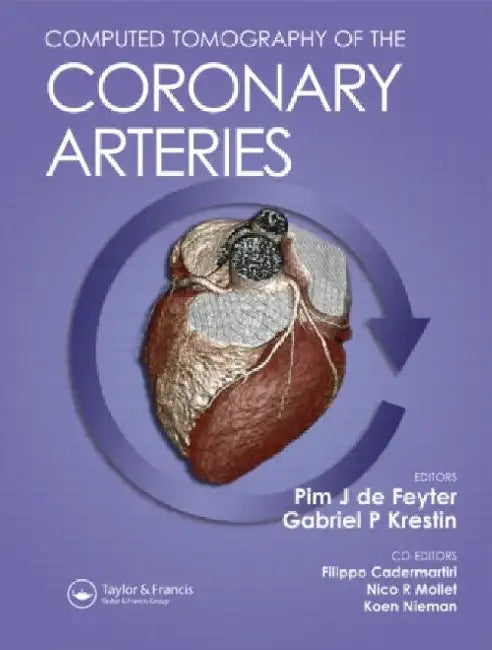Computed Tomography Of The Coronary Arteries 