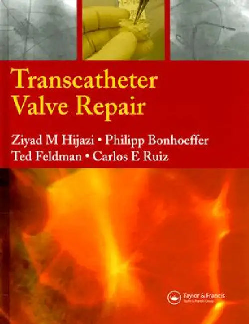 Transcatheter Valve Repair by Ziyad M. Hijazi, Carlos E. Ruiz, Philipp Bonhoeffer