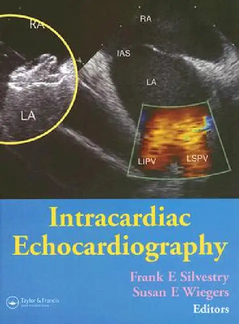 Intracardiac Echocardiography by Frank E. Silvestry