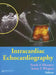 Intracardiac Echocardiography by Frank E. Silvestry