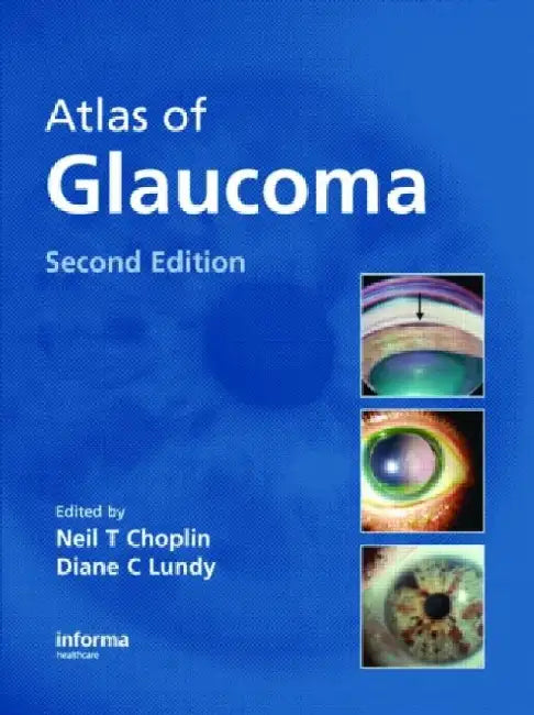 Atlas Of Glaucoma 