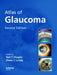 Atlas Of Glaucoma 