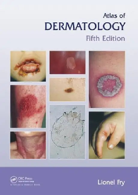 Atlas of Dermatology by Lionel Fry