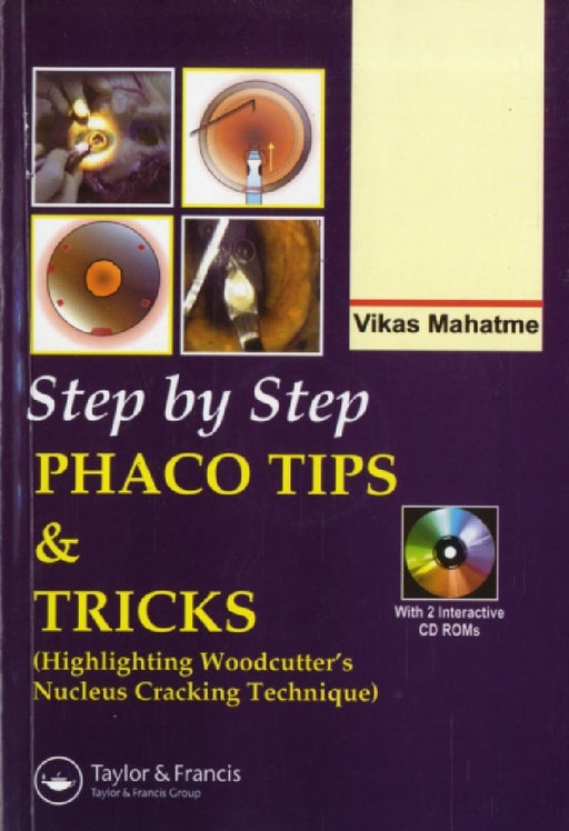 Step By Step Phacoemulsification: Tips and Tricks by Vikas Mahatme