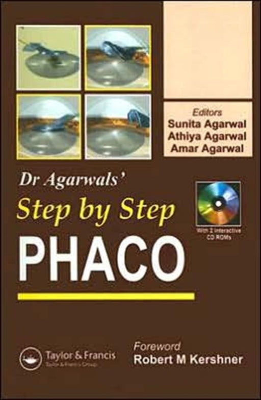 Step By Step Phacoemulsification by Sunita Agarwal, Athiya Agarwal