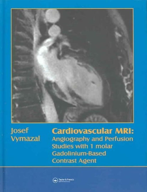 Cardiovascular Mri by Josef Vymazal