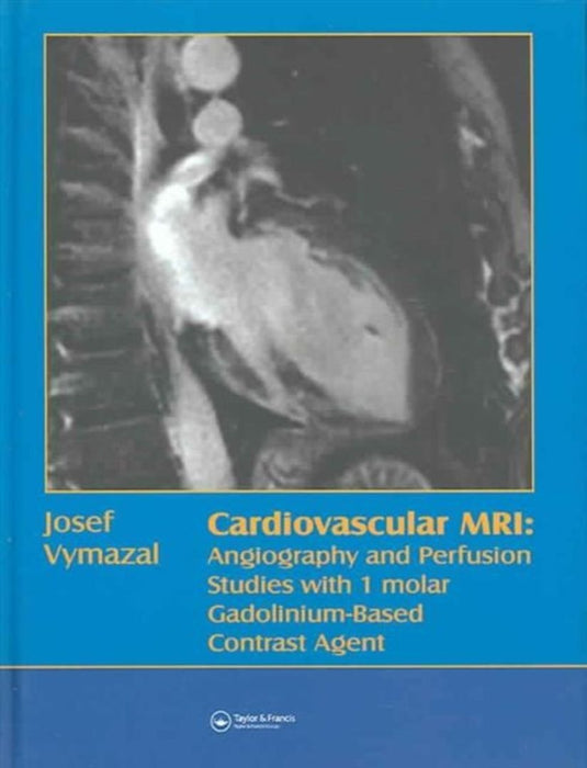 Cardiovascular Mri by Josef Vymazal