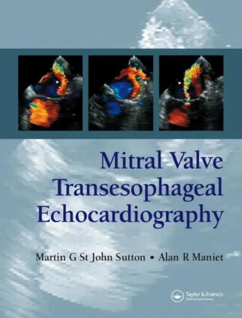 Mitral Valve Transesophageal Echocardiography by Martin G. St. John Sutton