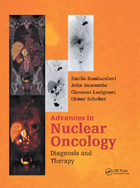 Advances in Nuclear Oncology: Diagnosis and Therapy by Emilio Bombardieri