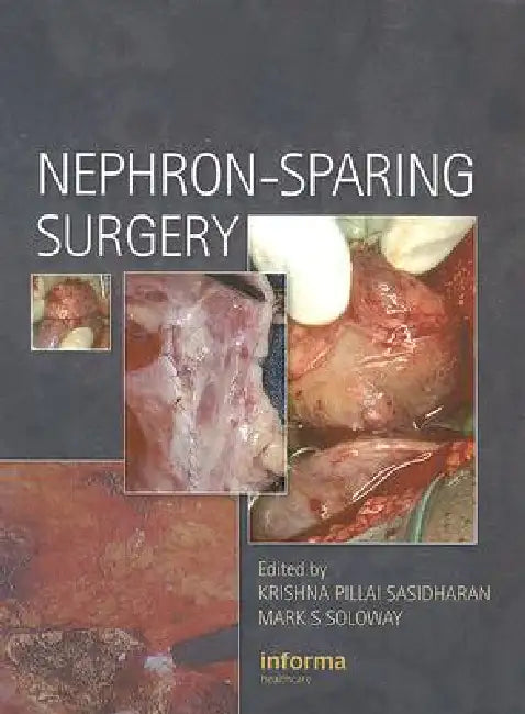 Nephron-Sparing Surgery by Krishna Sasidharan