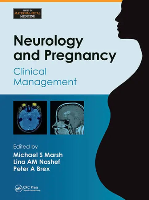 Neurology and Pregnancy: Clinical Management by Michael S. Marsh