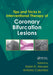 Tips and Tricks in Interventional Therapy of Coronary Bifurcation Lesions by 