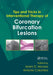 Tips and Tricks in Interventional Therapy of Coronary Bifurcation Lesions
