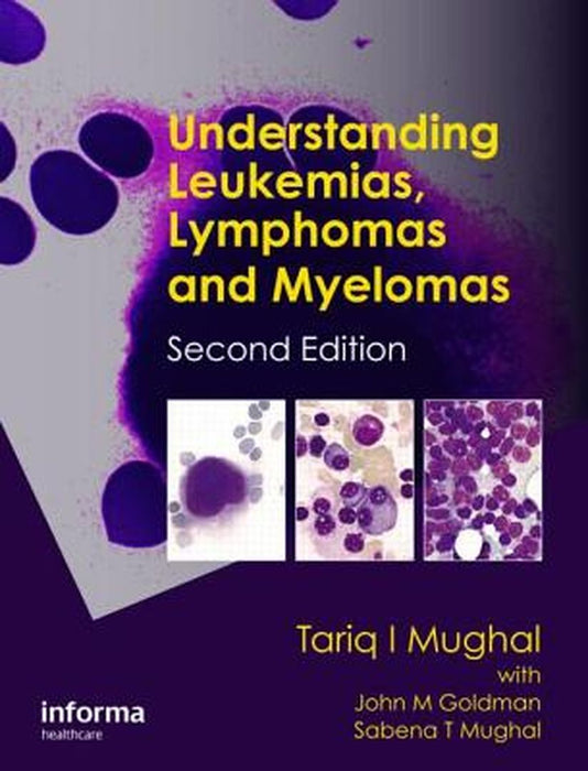 Understanding Leukemias, Lymphomas and Myelomas by Tariq I. Mughal