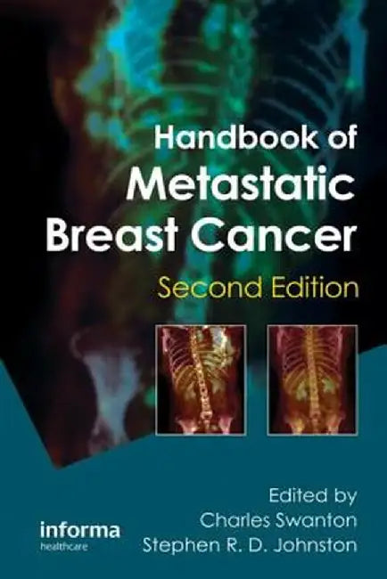 Handbook of Metastatic Breast Cancer by Charles Swanton
