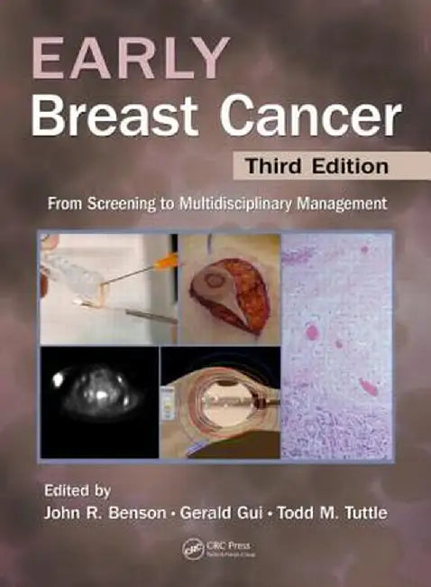Early Breast Cancer: From Screening to Multidisciplinary Management by John R Benson
