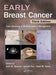 Early Breast Cancer: From Screening to Multidisciplinary Management by John R Benson