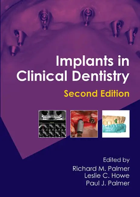 Implants in Clinical Dentistry by Richard M. Palmer