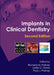 Implants in Clinical Dentistry by Richard M. Palmer