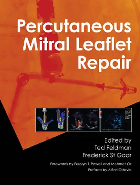 Percutaneous Mitral Leaflet Repair: Mitraclip Therapy for Mitral Regurgitation by Ted Feldman