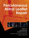 Percutaneous Mitral Leaflet Repair: Mitraclip Therapy for Mitral Regurgitation by Ted Feldman