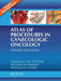Atlas of Procedures in Gynecologic Oncology by Nadeem R. Abu-Rustum