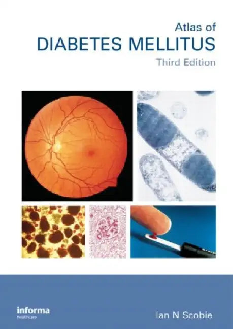 An Atlas Of Diabetes Mellitus by Ian N. Scobie