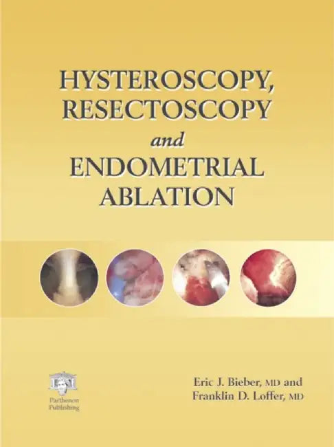 Hysteroscopy, Resectoscopy And Endometrial Ablation by Eric J. Bieber, Franklin D. Loffer