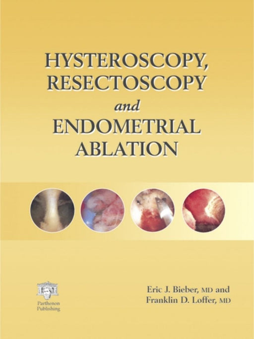 Hysteroscopy, Resectoscopy And Endometrial Ablation by Eric J. Bieber, Franklin D. Loffer