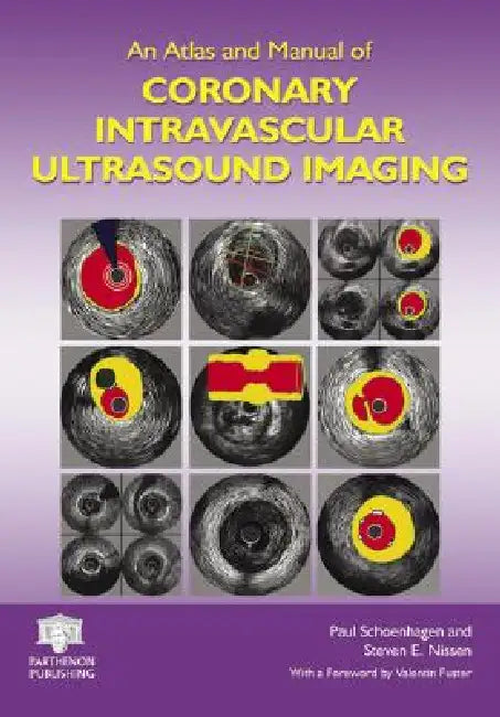 An Atlas and Manual of Coronary Intravascular Ultrasound Imaging by Paul Schoenhagen