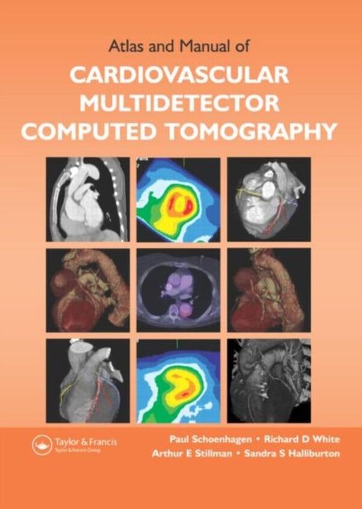 Atlas And Manual Of Cardiovascular Multi-Detector Computed To Mography by Eric J. Topol, Others