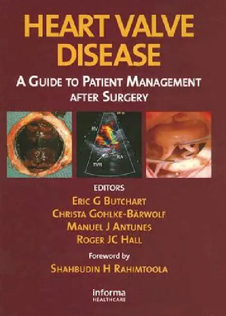 Heart Valve Disease: A Guide to Patient Management After Surgery by Eric G. Butchart