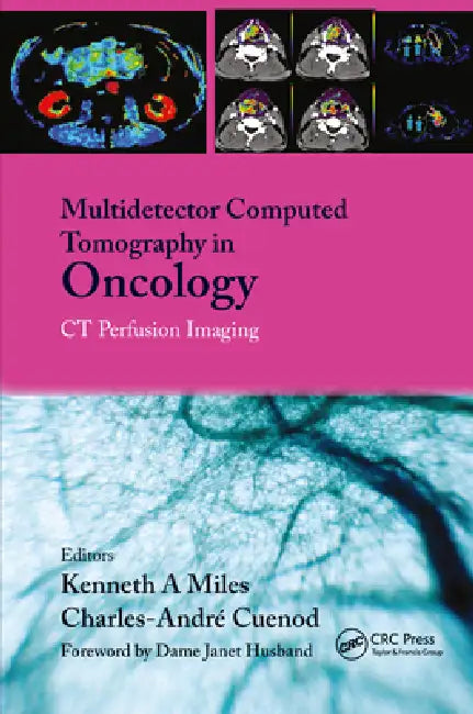 Multi-Detector Computed Tomography in Oncology: CT Perfusion Imaging by Kenneth Miles