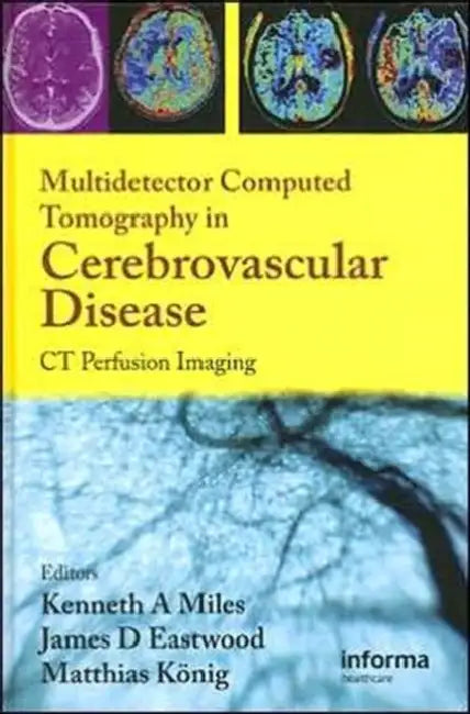 Multidetector Computed Tomography in Cerebrovascular Disease: CT Perfusion Imaging by Kenneth Miles, James D. Eastwood, Matthias Konig