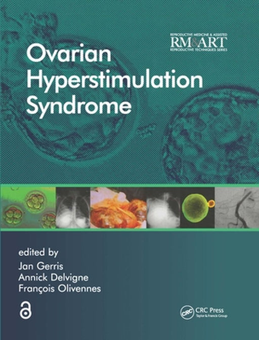 Ovarian Hyperstimulation Syndrome by Jan Gerris, Annick Delvigne, Francois Olivennes