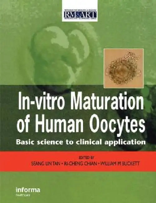 In Vitro Maturation of Human Oocytes by Seang Lin Tan