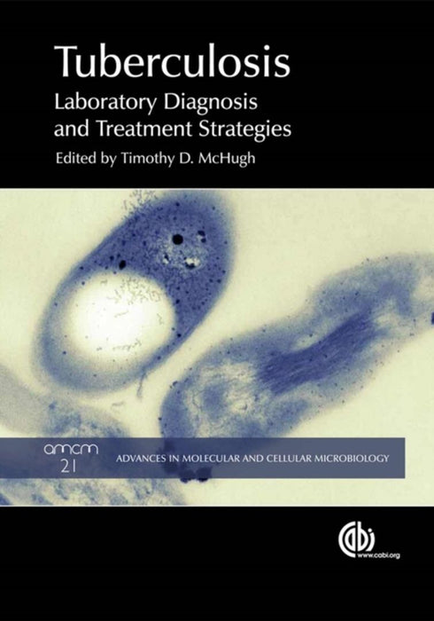 Tuberculosis: Diagnosis and Treatment by Timothy D. McHugh