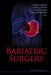 Bariatric Surgery by Hakim Nadey S
