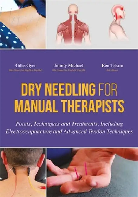 Dry Needling for Manual Therapists: Points, Techniques and Treatments, Including Electroacupuncture and Advanced Tendon Techniques by Giles Gyer