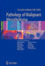 Pathology of Malignant Mesothelioma by Francoise Galateau-Sallé
