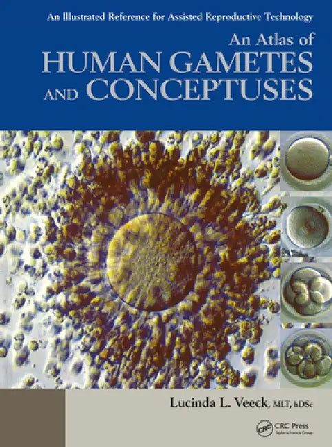 An Atlas of Human Gametes and Conceptuses: An Illustrated Reference for Assisted Reproductive Technology by Lucinda L. Veeck