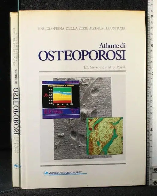 An Atlas of Hypertension by Peter F. Semple, George B.M. Lindop