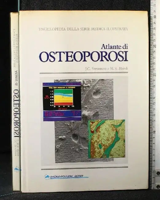 An Atlas of Hypertension by Peter F. Semple, George B.M. Lindop